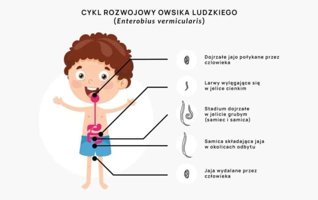 Skąd się biorą owsiki i jak uniknąć zarażenia nimi? Skąd się biorą owsiki i jak uniknąć zarażenia nimi?