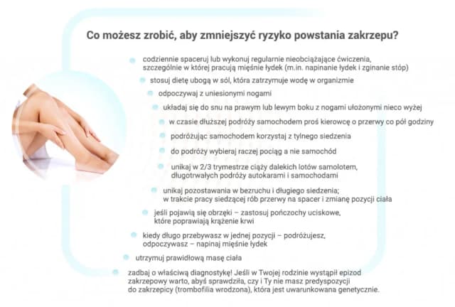 Jak zapobiec zakrzepicy: skuteczne metody i proste zmiany w stylu życia Jak zapobiec zakrzepicy: skuteczne metody i proste zmiany w stylu życia